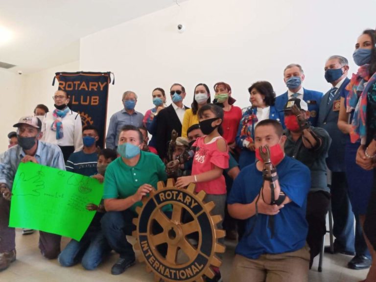 Gestionan prótesis de manos para personas de escasos recursos de Nocupétaro