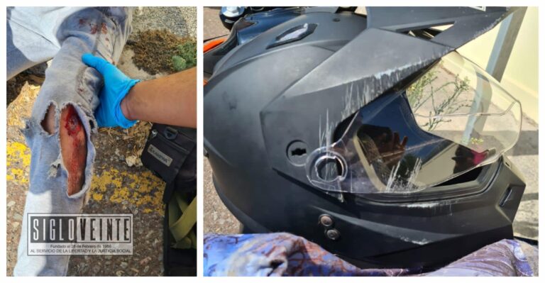 Resulta lesionado joven de 17 años por derrape de motocicleta