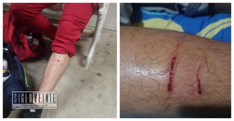 Manada de perros ataca a mamá, bebé y varios jóvenes