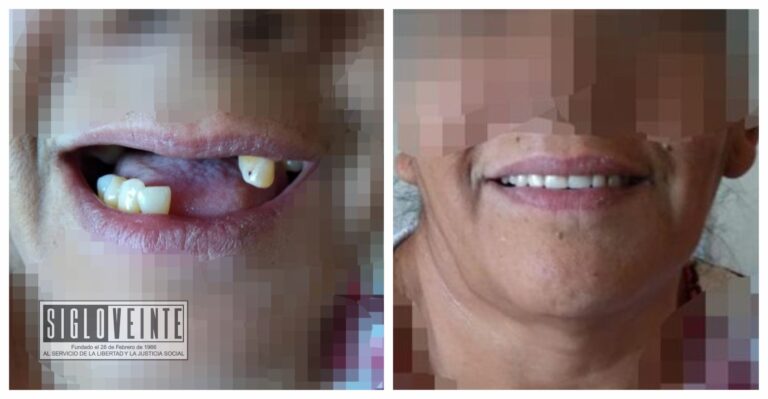 Gobierno y DIF de Juárez entregan prótesis dentales a adultos mayores