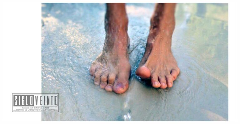La Secretaría de Salud de Michoacán invita a cuidar los pies en temporada de calor