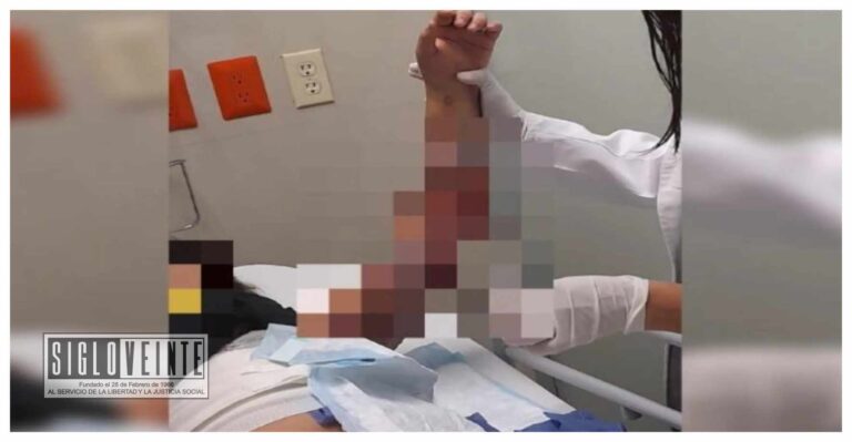 En un albergue de Tonalá, Jalisco, torturan y queman a niña de 11 años