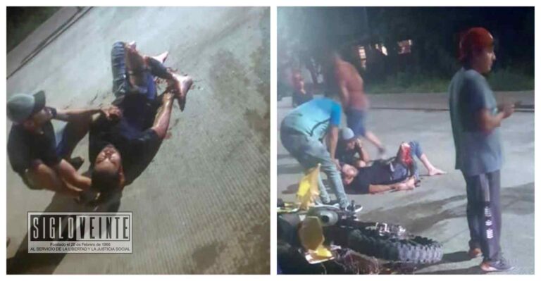 Conductor de moto pierde una pierna al chocar con una camioneta en Antúnez