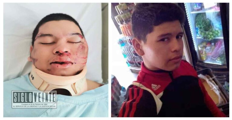Se solicita apoyo para localizar a familiares de paciente internado en Hospital del IMSS de Huetamo, sufrió accidente en moto