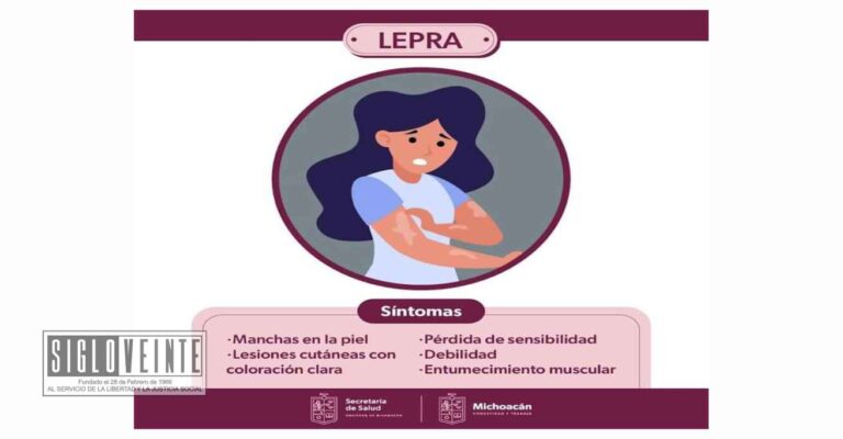 Michoacán garantiza la atención gratuita a pacientes con lepra, en los 364 centros de salud y 27 hospitales de la Secretaría de Salud