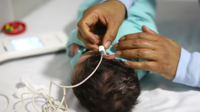 Arranca programa de implantes auditivos gratuitos para menores de 6 años: SSM