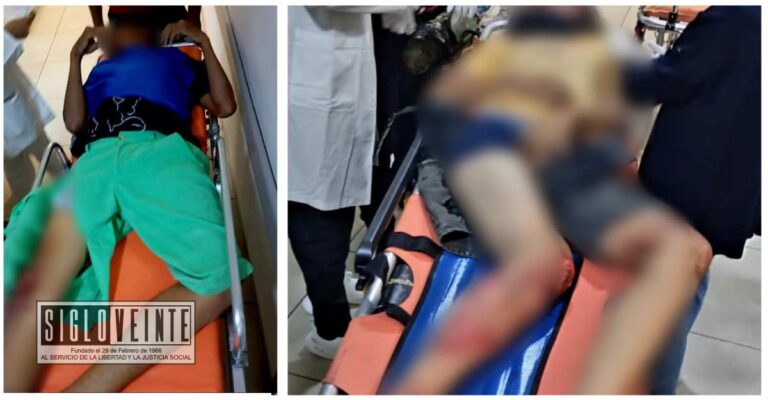 Derrape en moto en la carretera Apatzingán a Cuatro Caminos causa lesiones a dos jóvenes, uno de ellos está grave