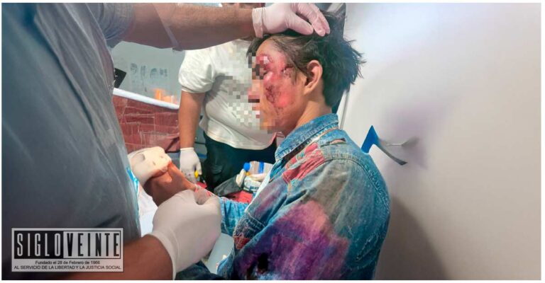 En Huetamo, un motociclista sufre severas lesiones en la cabeza al derrapar sin casco