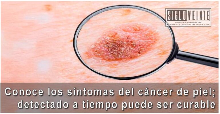 Conoce los síntomas del cáncer de piel; detectado a tiempo puede ser curable