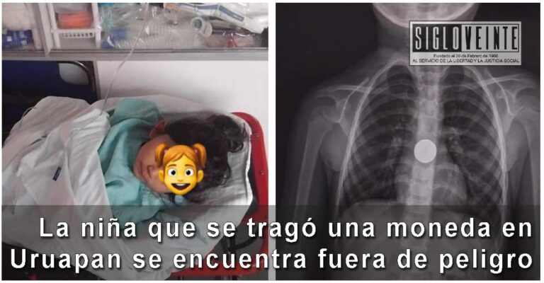 La niña que se tragó una moneda en Uruapan se encuentra fuera de peligro