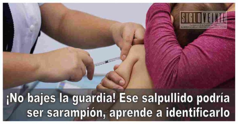 Ese salpullido podría ser sarampión, aprende a identificarlo