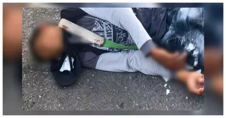 Automovilista embiste a motociclista y escapa; lesionado es hospitalizado en Apatzingán