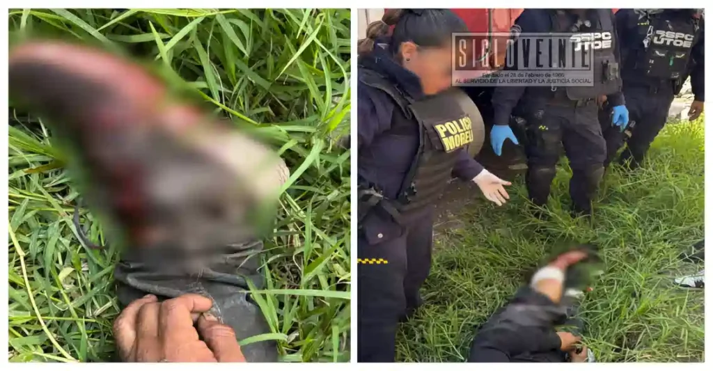Hombre sufre lesión en un pie cerca de la Central de Abastos de Morelia; no quiso ser llevado en ambulancia